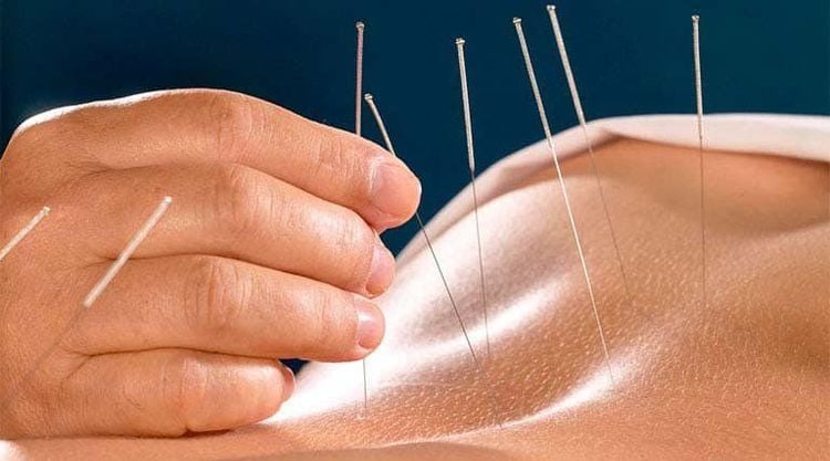 Khám đông y (Y Học Cổ Truyền) là gì?