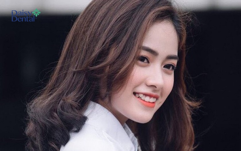 Theo văn hóa phương Đông răng khểnh sẽ mang tới nhiều may mắn cho người sở hữu