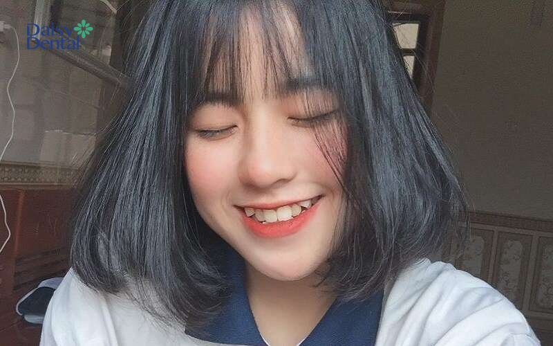 Gái xinh răng khểnh với nụ cười trong sáng
