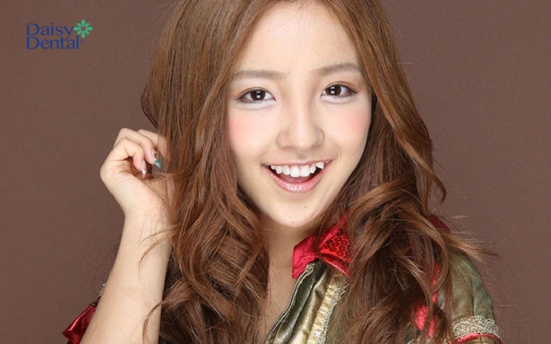 Gái xinh răng khểnh phong cách Nhật Bản