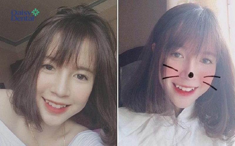 Gái xinh răng khểnh Quảng Ninh