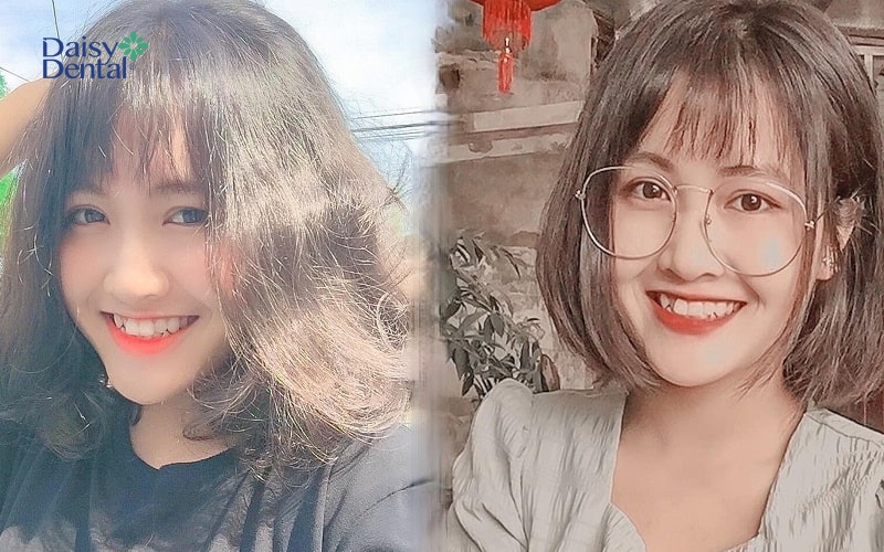 Nữ sinh gây thương nhớ với nụ cười răng khểnh cực xinh