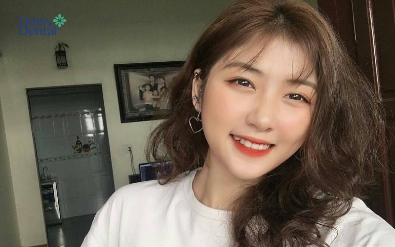 Một nụ cười răng khểnh làm xao xuyến người nhìn