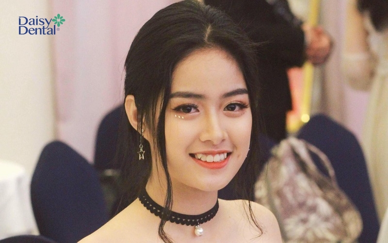 Vẻ đẹp ngọt ngào của nụ cười răng khểnh