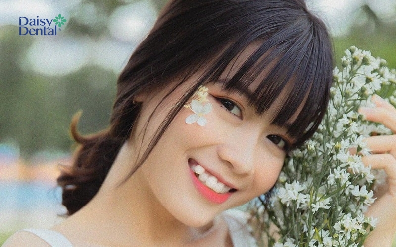 Nụ cười đẹp chuẩn nụ cười răng khểnh
