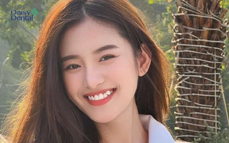 Nụ cười răng khểnh có thể làm xao xuyến người đối diện