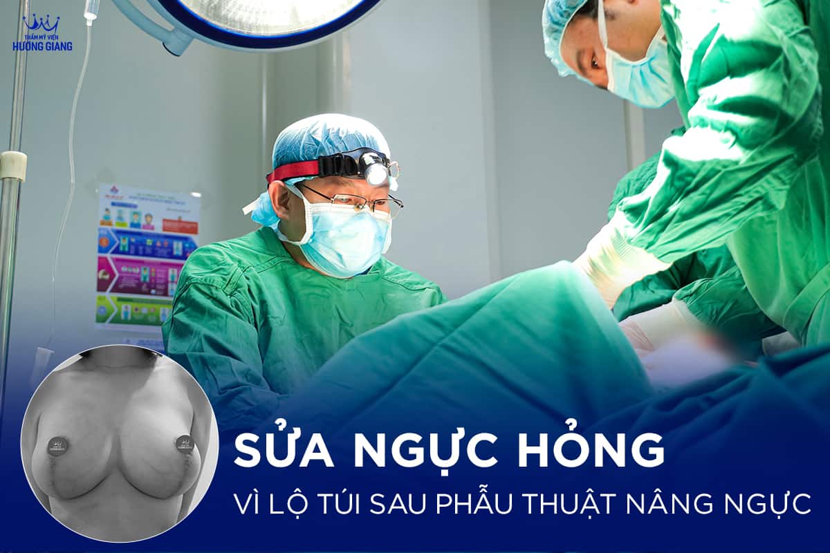 Sửa ngực hỏng vì lộ túi sau phẫu thuật nâng ngực