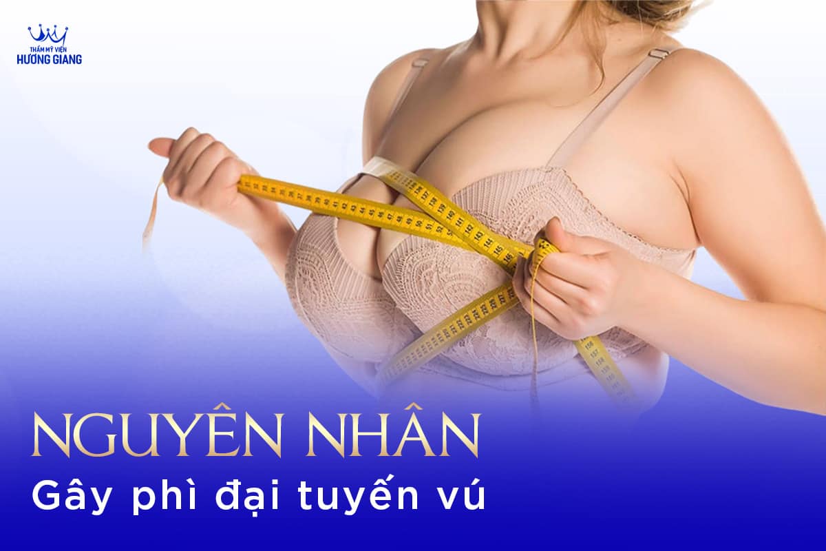 Nỗi ám ảnh ngực phì đại ở nữ giới!