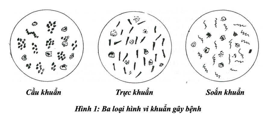 Vi khuẩn là gì? Hình thể, cấu trúc và sinh lý?