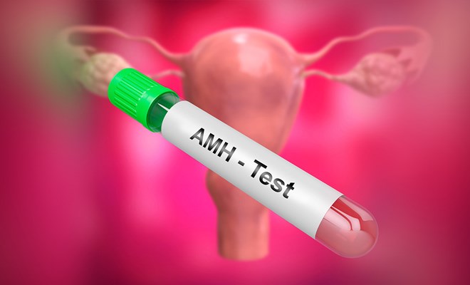 Nên xét nghiệm AMH vào thời điểm nào?