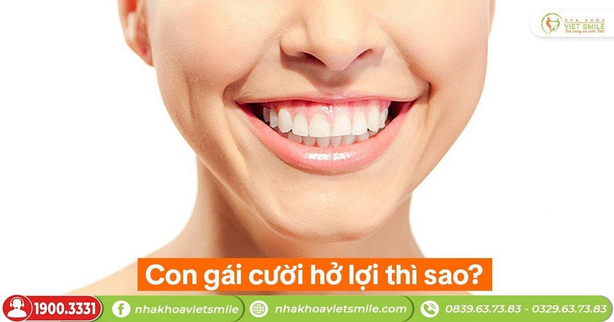 Con gái cười hở lợi thì sao?