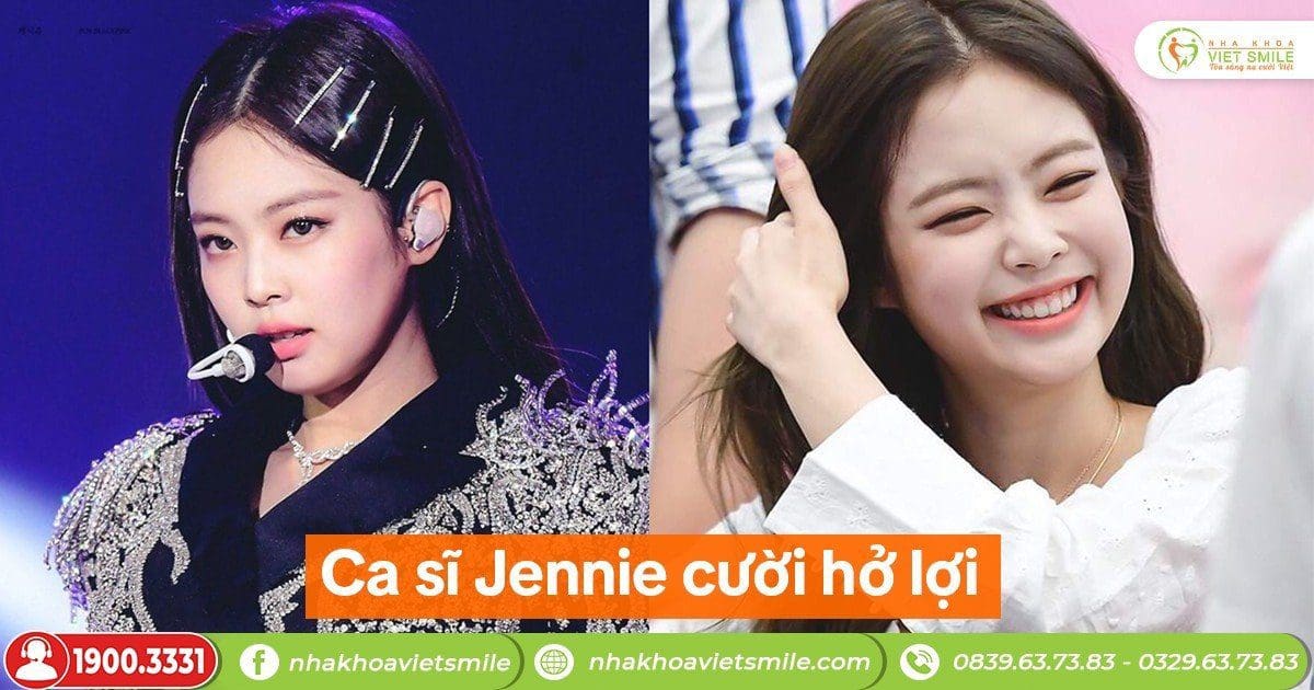 Ca sĩ Jennie cười hở lợi