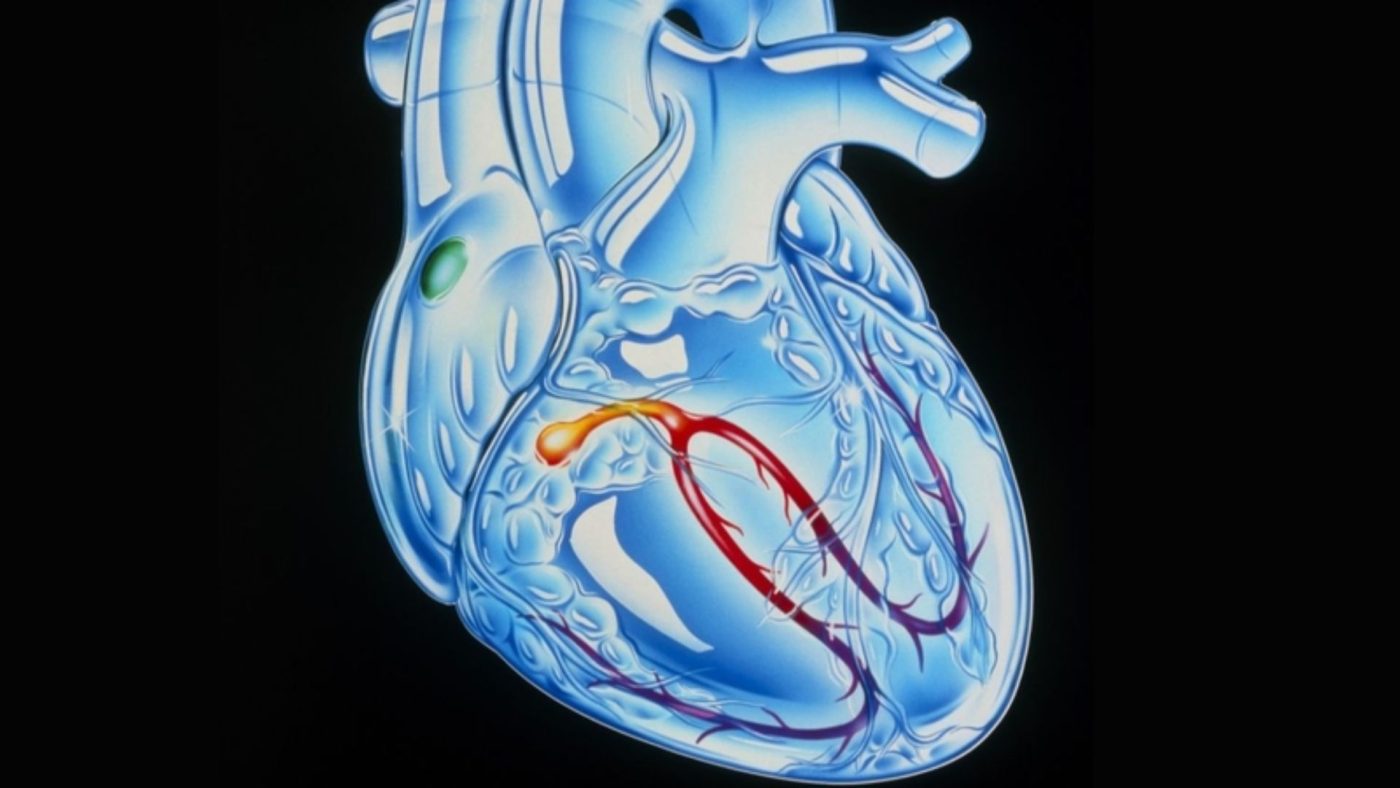 Hệ dẫn truyền tim là gì? Cấu tạo, chức năng và vai trò sống còn của nhịp tim