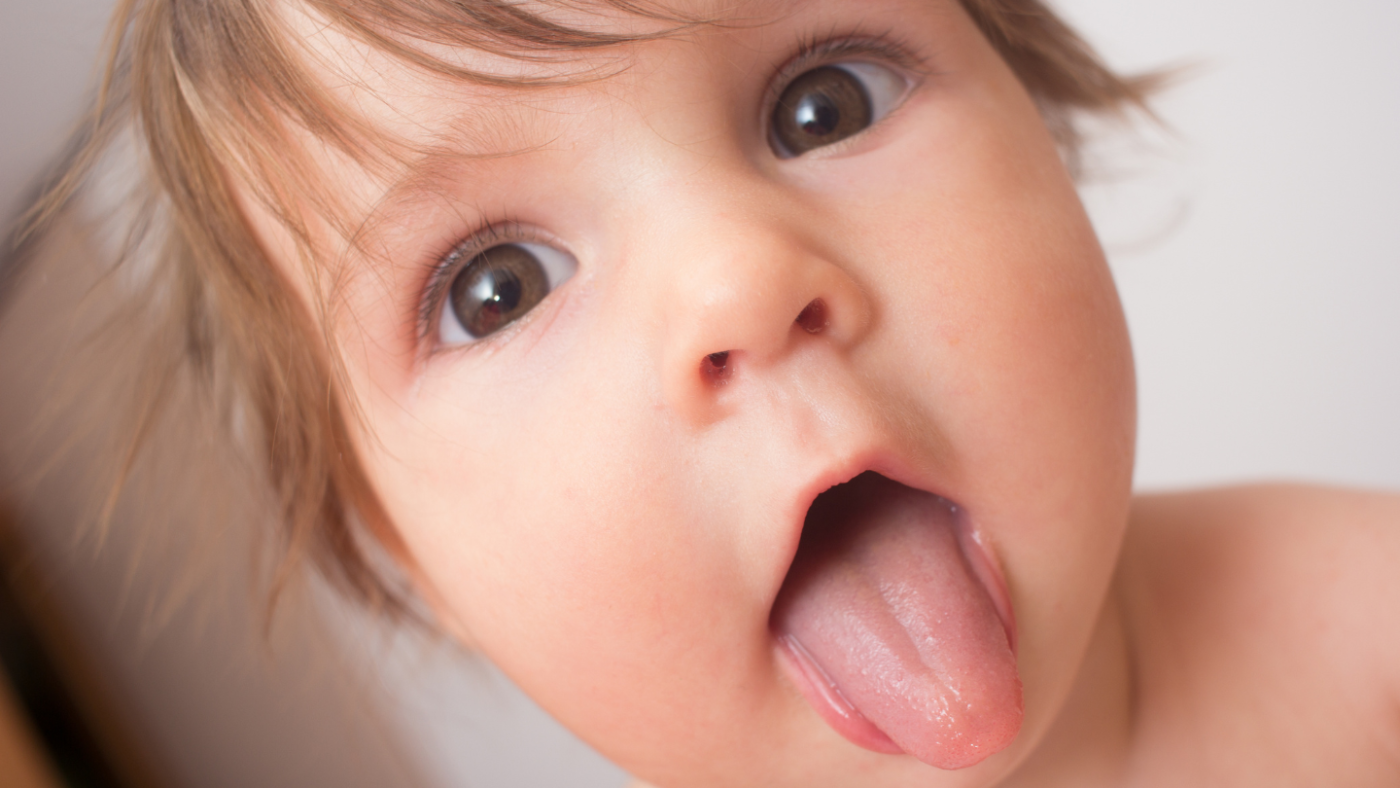 Hình ảnh trẻ không bị dính thắng lưỡi và dấu hiệu trẻ bị dính thắng lưỡi