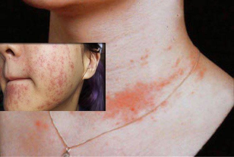 Thủy ngân bay hơi ở nhiệt độ nào?