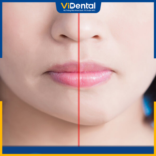 Khuôn Mặt Bị Lệch Khi Chụp Ảnh: Có Liên Quan Đến Răng Miệng?