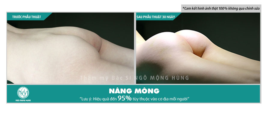 Quần nâng mông chảy xệ