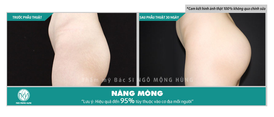 Quần nâng mông chảy xệ