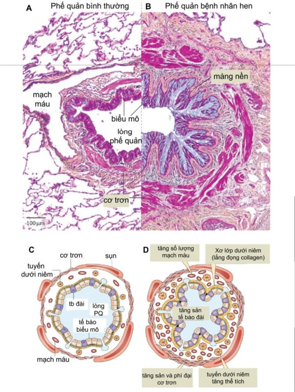 HỘI HÔ HẤP TP. HỒ CHÍ MINH