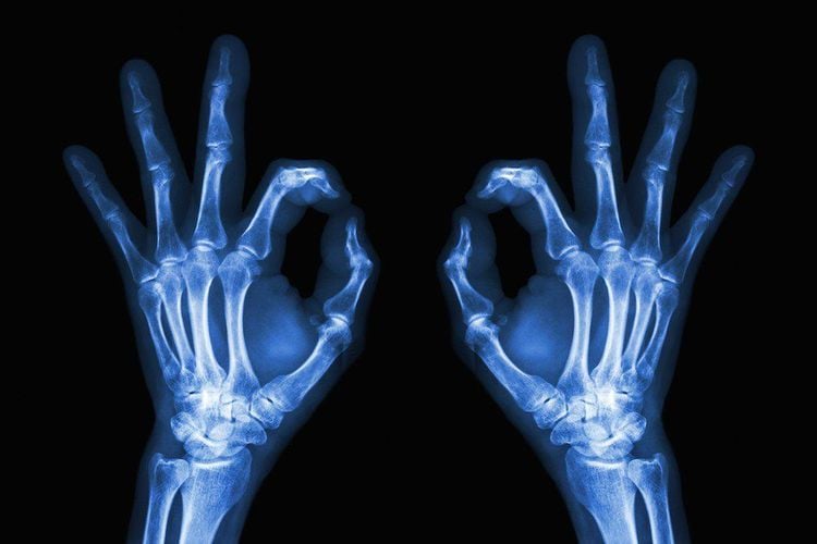 Khả năng xuyên thấu của tia X