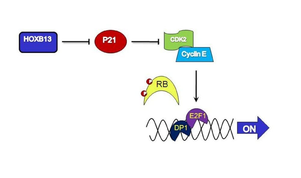 Vai trò và sự liên quan của gene HOXB13 ở bệnh nhân ung thư tuyến tiền liệt