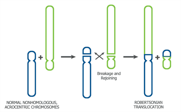 Chuyển đoạn Robertson