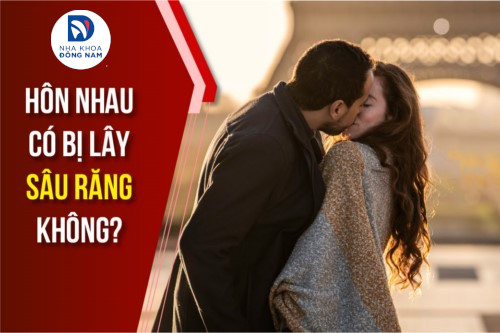 Hôn Nhau Có Bị Lây Sâu Răng Hay Không?