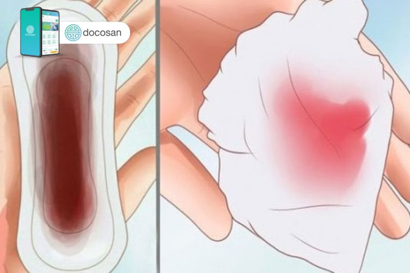 Khí hư màu nâu đỏ: Nguyên nhân và cách điều trị dứt điểm