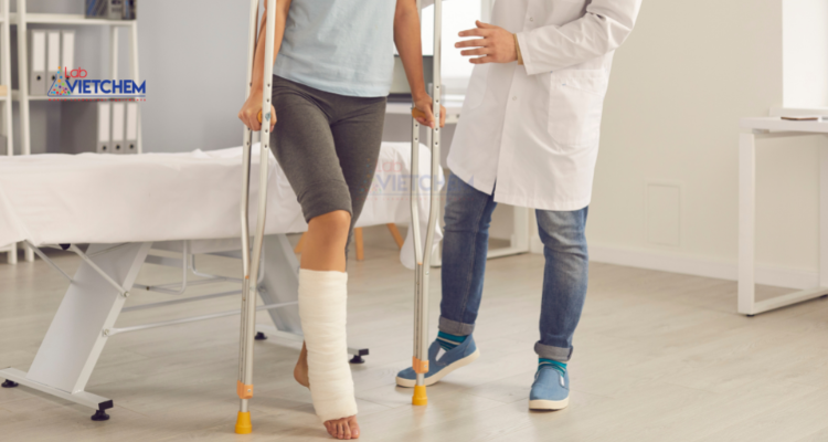 Ứng dụng trong bó bột cố định xương bị gãy