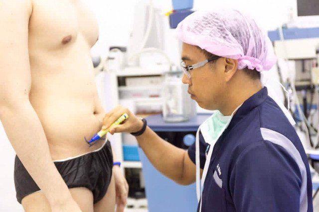 Đây là quá trình đau đớn nhưng tiết kiệm nhiều thời gian cho nam giới.