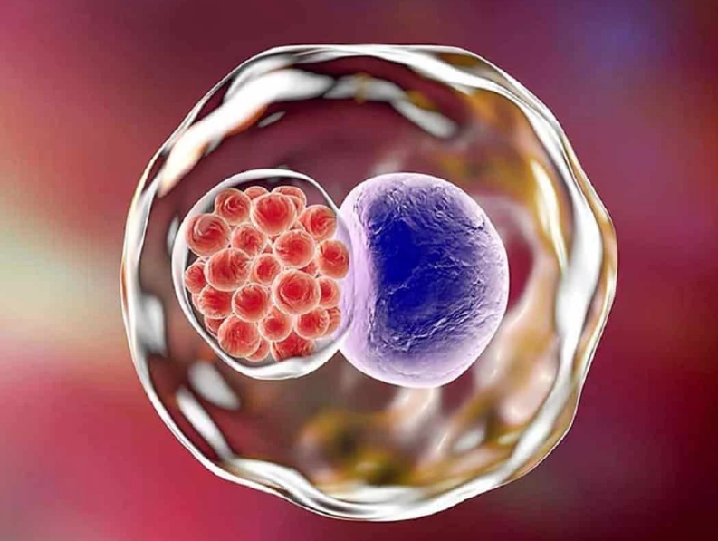 Đau bụng dưới âm ỉ là do những bệnh lý gì? 3