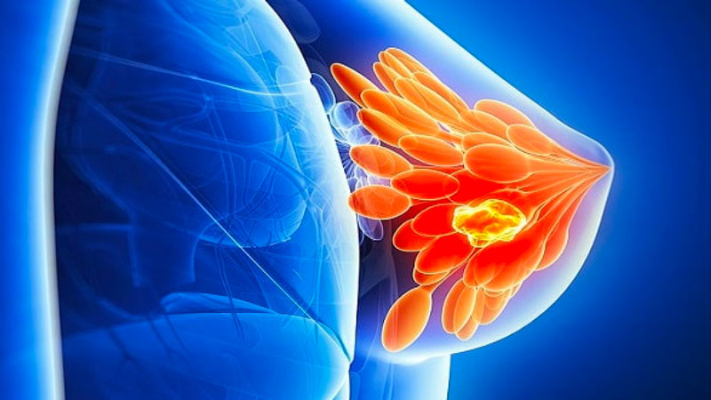 Ngực có cục cứng đau nguyên nhân do đâu?