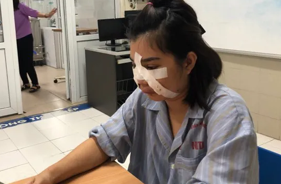 Sốc: Cô gái xinh đẹp mặt biến dạng, chi chít lỗ rò mủ sau 2 mũi tiêm mỡ tự thân - 3