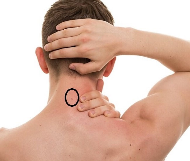 Nốt Ruồi Sau Gáy Nam Nữ Có Ý Nghĩa Gì? Giàu Hay Nghèo?