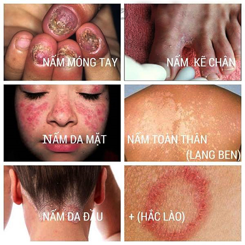 Đa dạng nấm KHTN 6 Cánh Diều</>