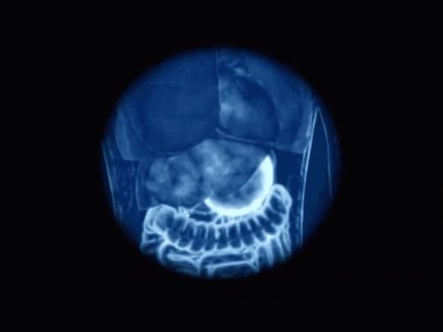 Axit trong dạ dày giúp phá vỡ thức ăn nhiều hơn