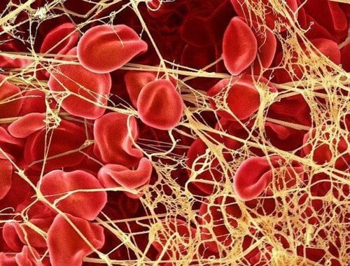 Có nhiều yếu tố ảnh hưởng đến quá trình đông máu của cơ thể