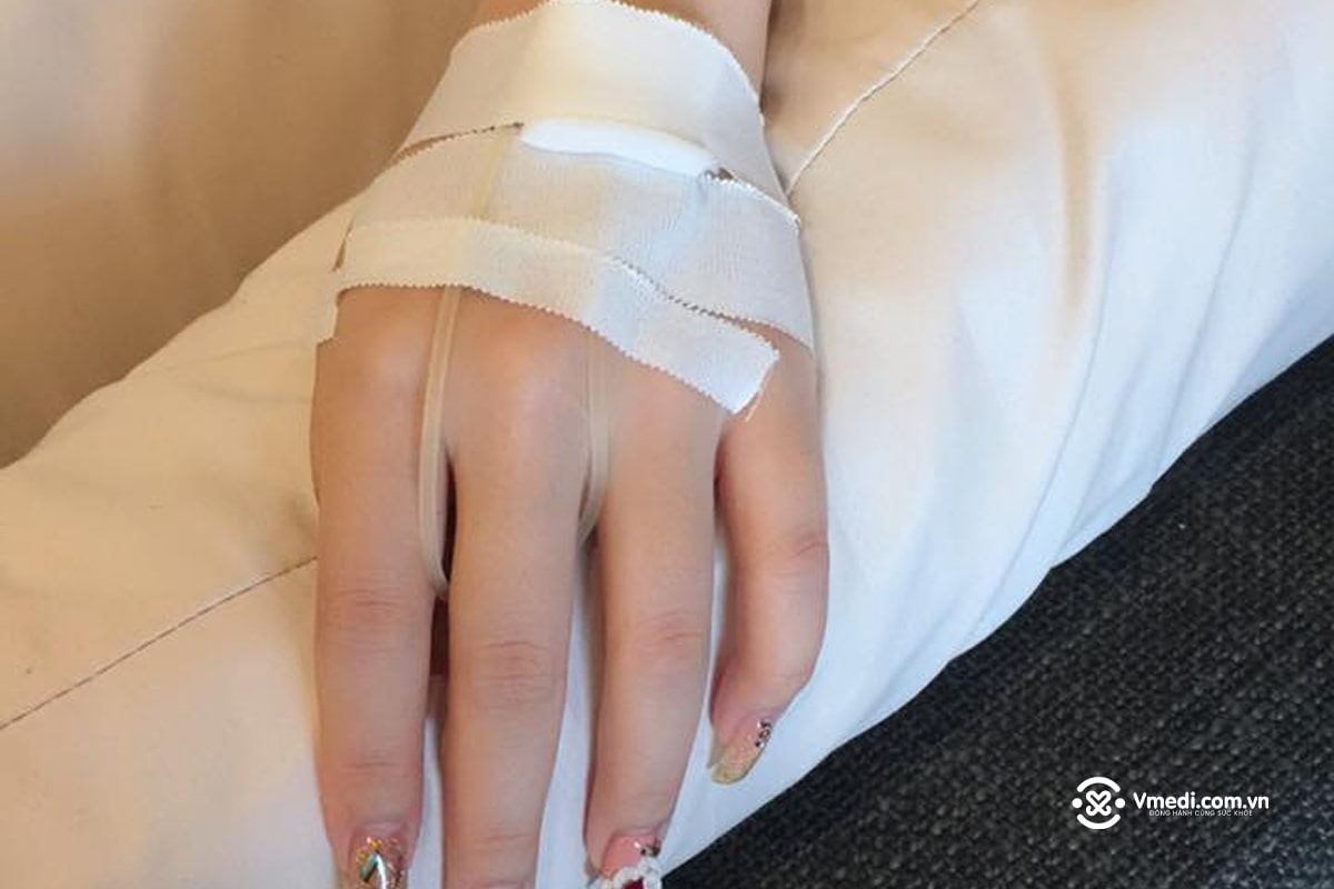 Tổng hợp 70+ hình ảnh truyền nước biển tại nhà và bệnh viện