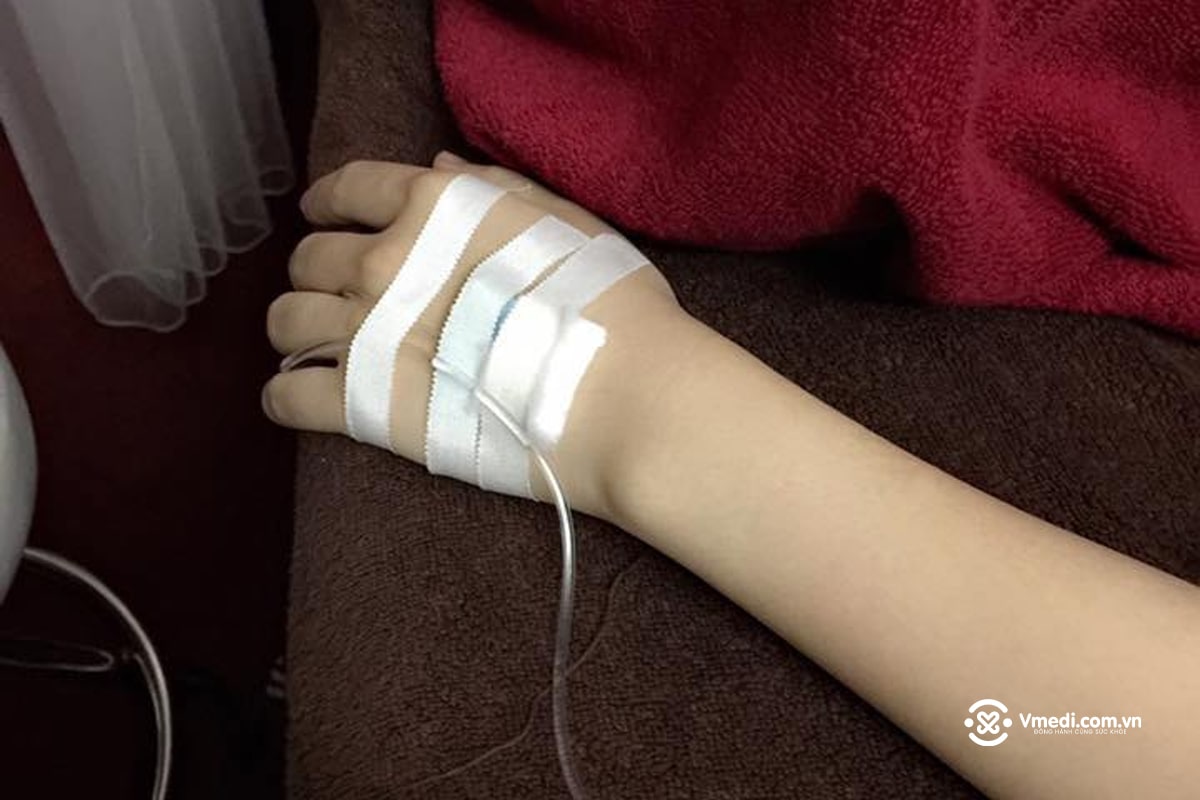 Tổng hợp 70+ hình ảnh truyền nước biển tại nhà và bệnh viện