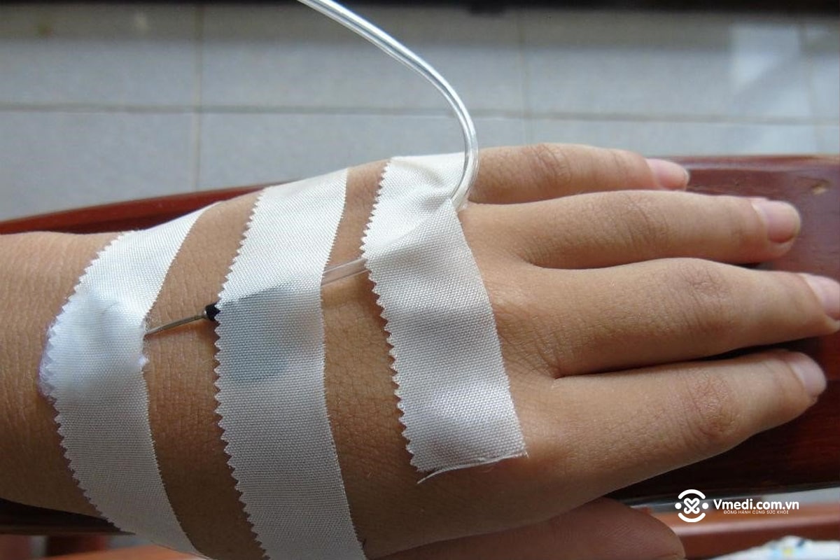 hinh-anh-canh-tay-truyen-nuoc