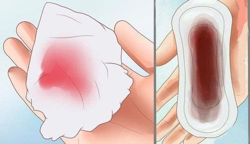 Kinh nguyệt ra nhiều có nguy hiểm không?