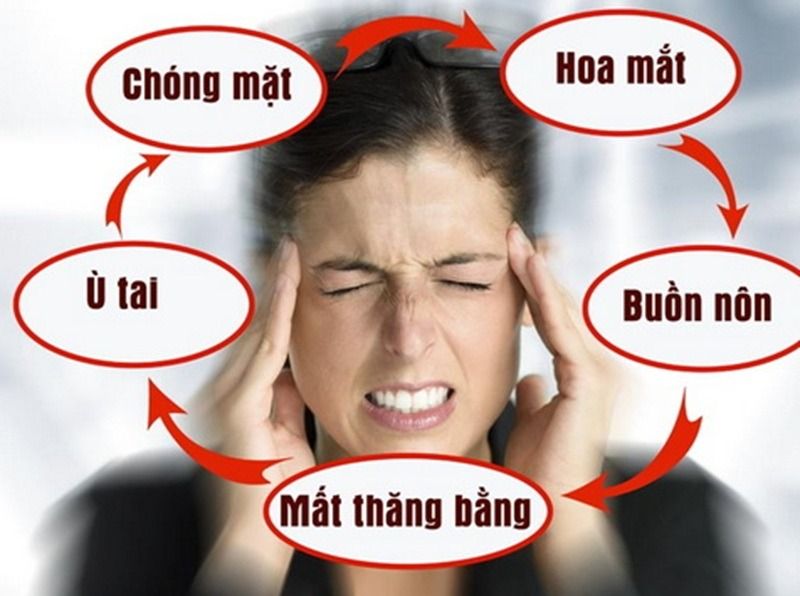 Meme tiền đình