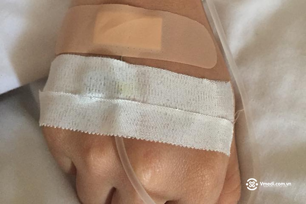 anh-nam-vien-truyen-nuoc