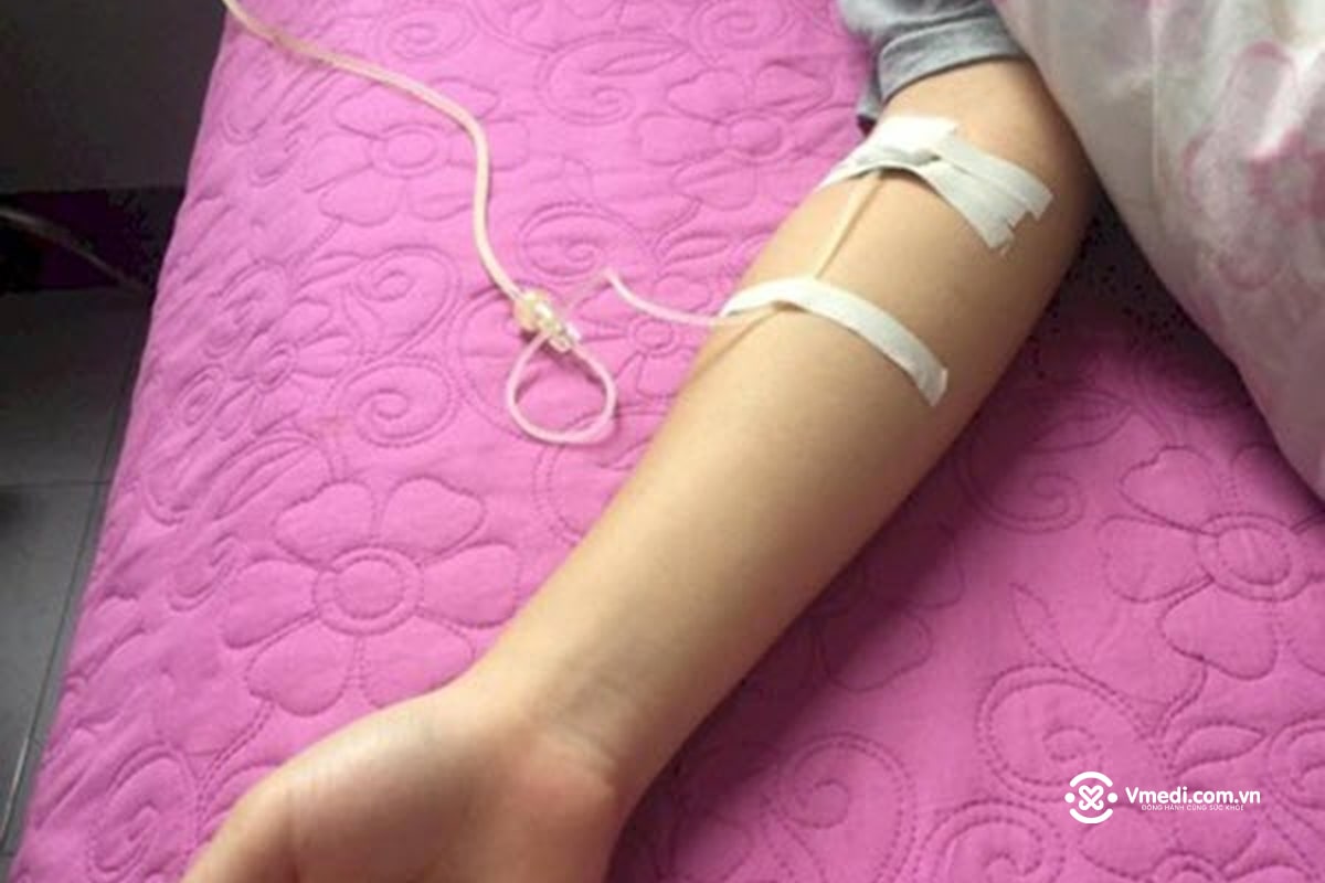 Tổng hợp 70+ hình ảnh truyền nước biển tại nhà và bệnh viện