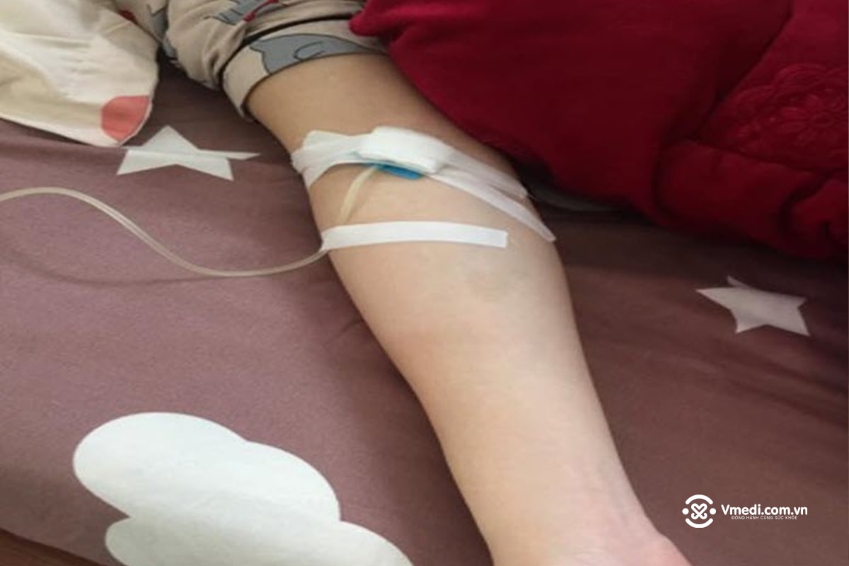 Tổng hợp 70+ hình ảnh truyền nước biển tại nhà và bệnh viện