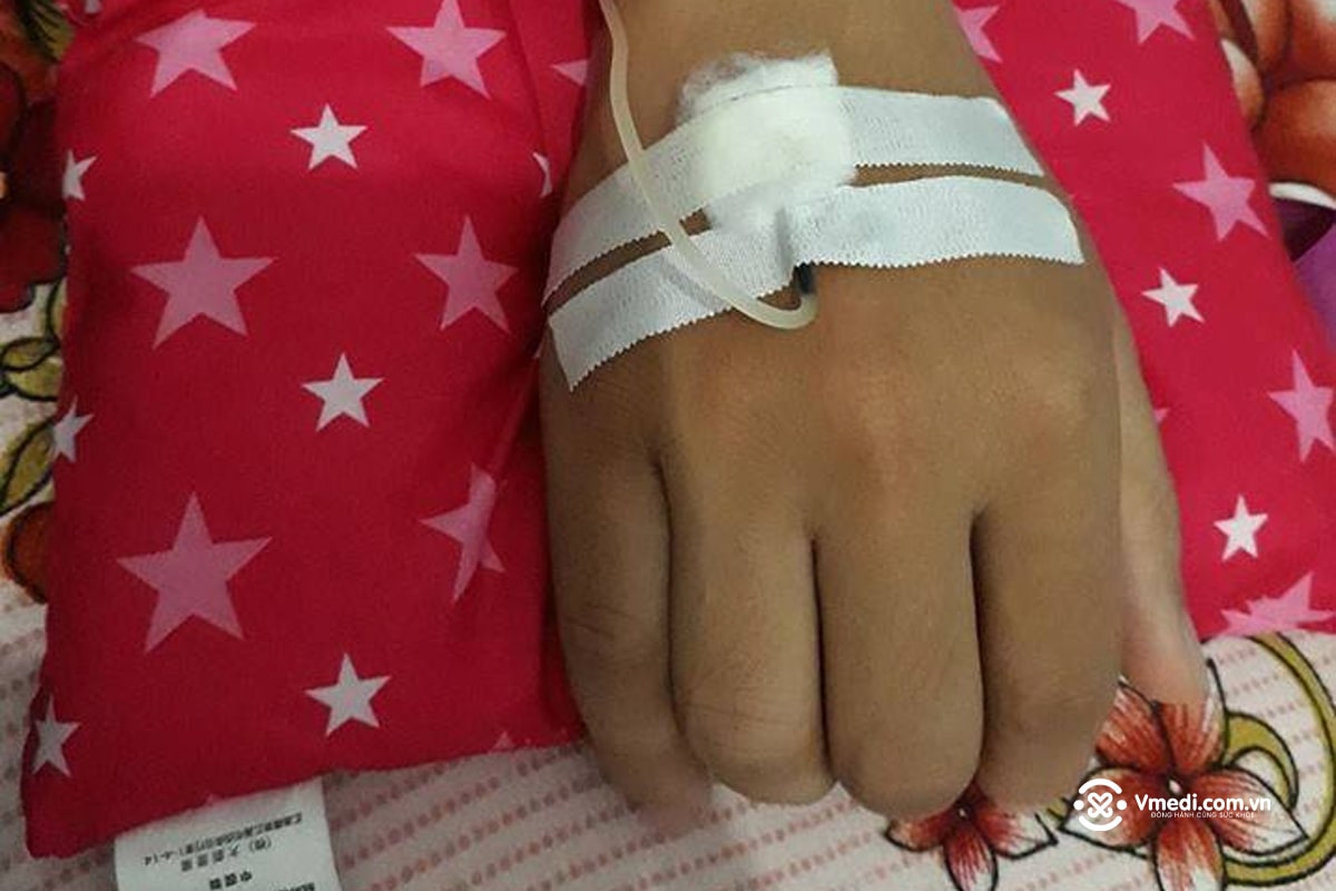 Tổng hợp 70+ hình ảnh truyền nước biển tại nhà và bệnh viện