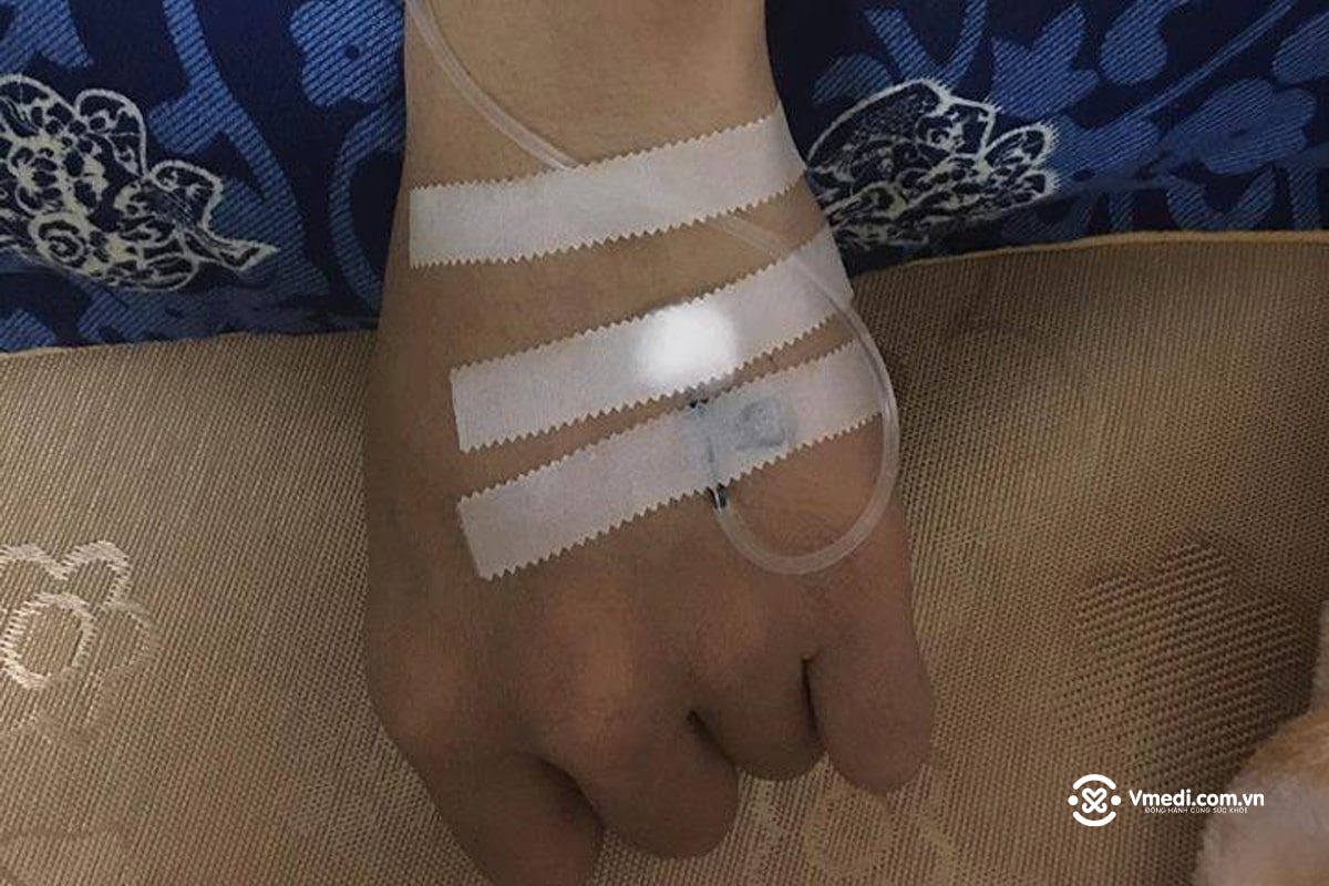 Tổng hợp 70+ hình ảnh truyền nước biển tại nhà và bệnh viện