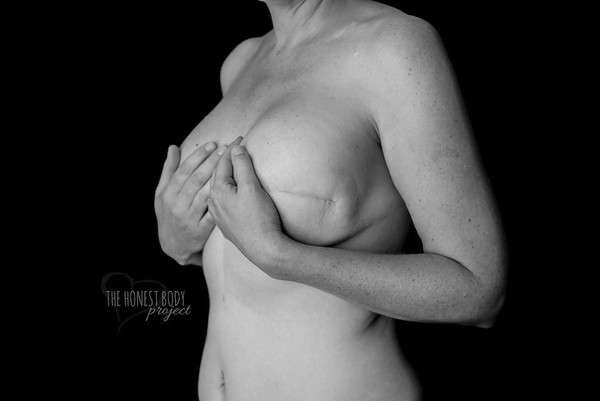 Vì sao lại có hai "Ngày không mặc áo ngực" trong năm?