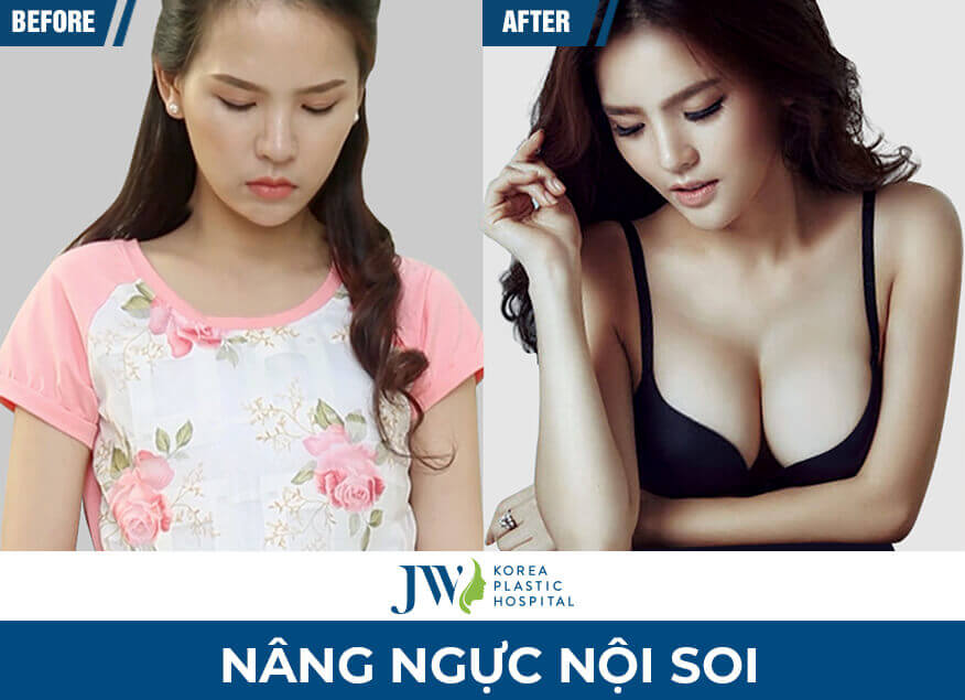 nang-nguc-golden-line