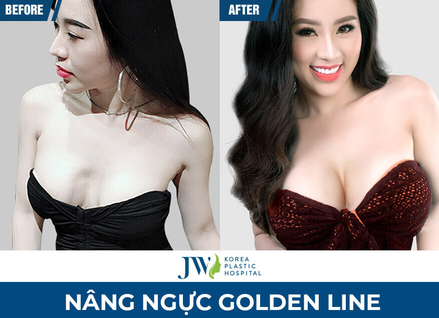 nang-nguc-golden-line